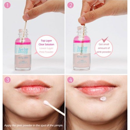 Bye bye Blemish for acne drying lotion giảm mụn