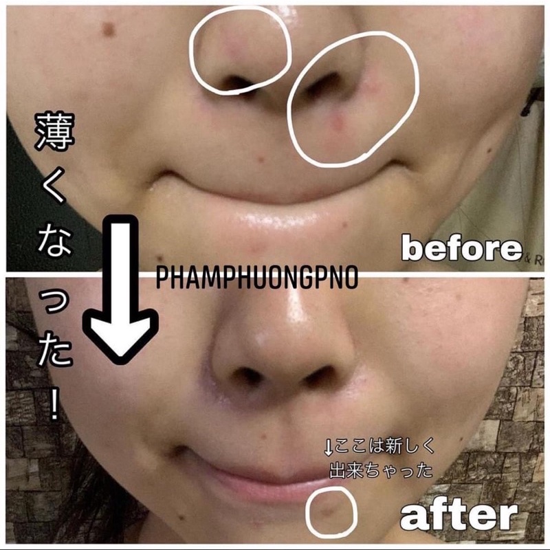 Gel dưỡng mờ thâm Melano CC