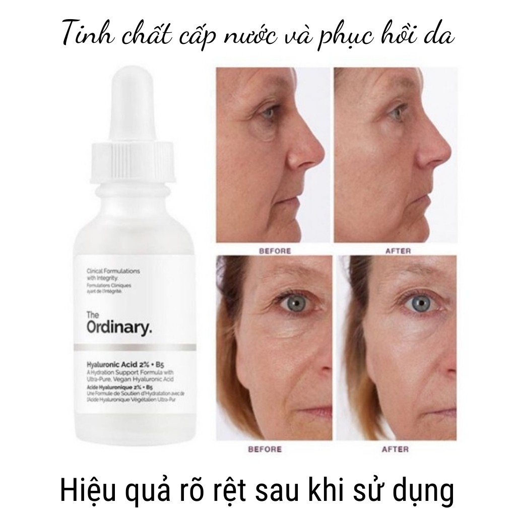 Serum B5 ORDINARY HYALURONIC 2% dưỡng da cấp ẩm phục hồi da dầu mụn 30ml - ZAVENCI Official