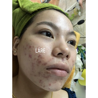 SERUM LÁRE THANH DƯỢC - SIZE 50ML