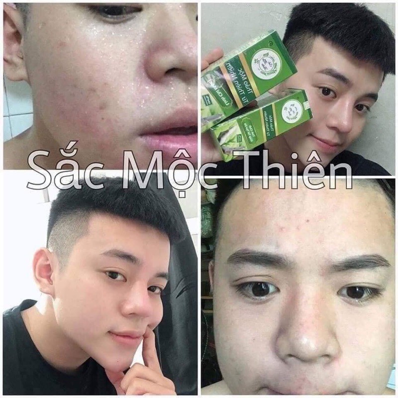 TINH CHẤT TÁI TẠO DA SẮC MỘC THIÊN - HỖ TRỢ CẢI THIỆN MỤN - NÁM - TÀN NHANG - SẸO RỖ | BigBuy360 - bigbuy360.vn