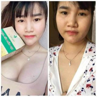(HÀNG CHÍNH HÃNG) Kẹo mầm lúa mạch gold