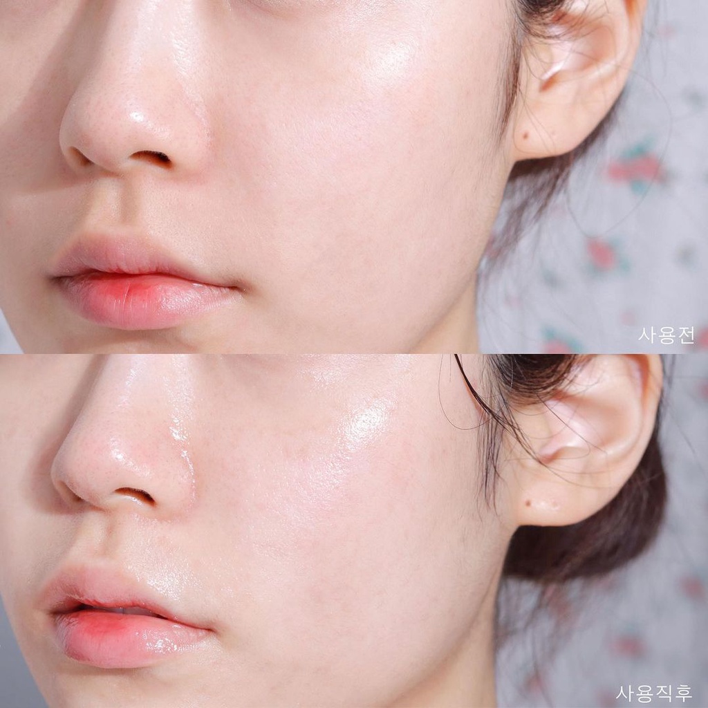 Mặt nạ MEDIHEAL mới