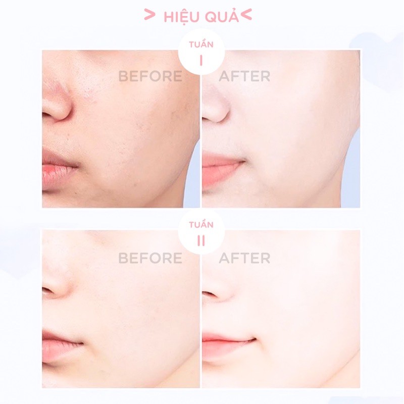 KEM VACCI DƯỠNG TRẮNG DA MẶT VACCI FACE CREAM SPF36PA++