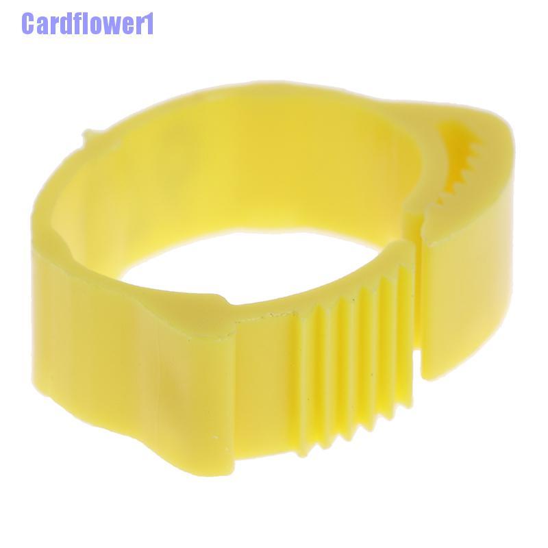 Bộ 100 Vòng Nhãn Dán Kỹ Thuật Số Có Thể Điều Chỉnh Cho Gia C