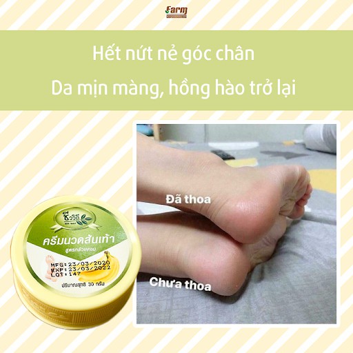 (Chính Hãng) Kem Chống Và Làm Lành Vết Nứt Gót Chân Banana Heel Cream 30g Thái Lan