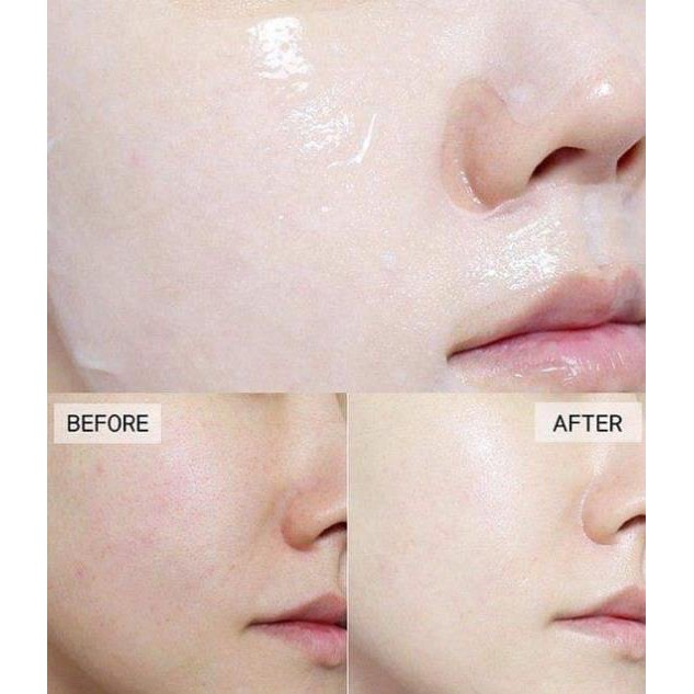 Mặt nạ nhau thai ngựa ,tế bào máu gốc cuống rốn Pwine beauty