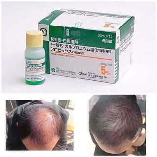THUỐC BÔI KÍCH THÍCH MỌC TÓC THẢO DƯỢC NHẬT SATO