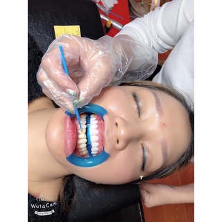 sứ  làm răng chamsima BL đức