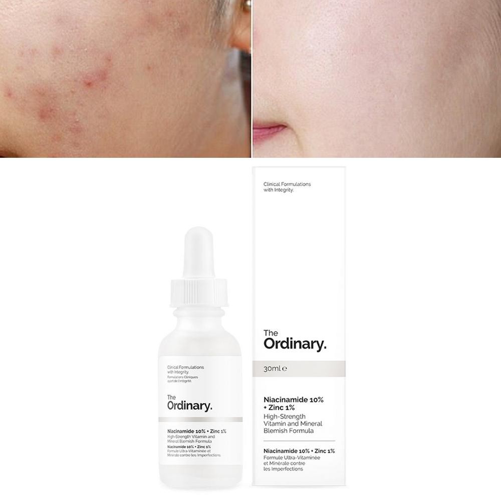 Tinh chất The Ordinary Niacinamide 10% + Zinc 1% giảm mụn, thu nhỏ lỗ chân lông