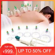 Sale Off 50% :Bộ 12 ly giác hơi không dùng lửa an toàn