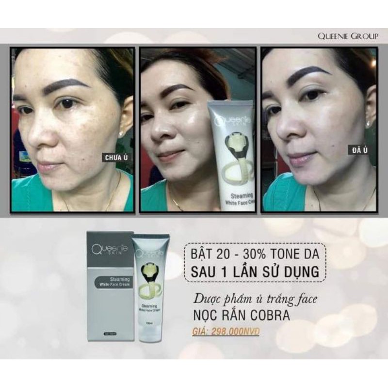 Ủ TRẮNG FACE COBRA QUEENIE SKIN | BigBuy360 - bigbuy360.vn