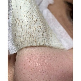 Gel lột mụn hàng Hanmade