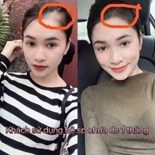 Combo 2 chai tinh dầu bưởi mọc tóc