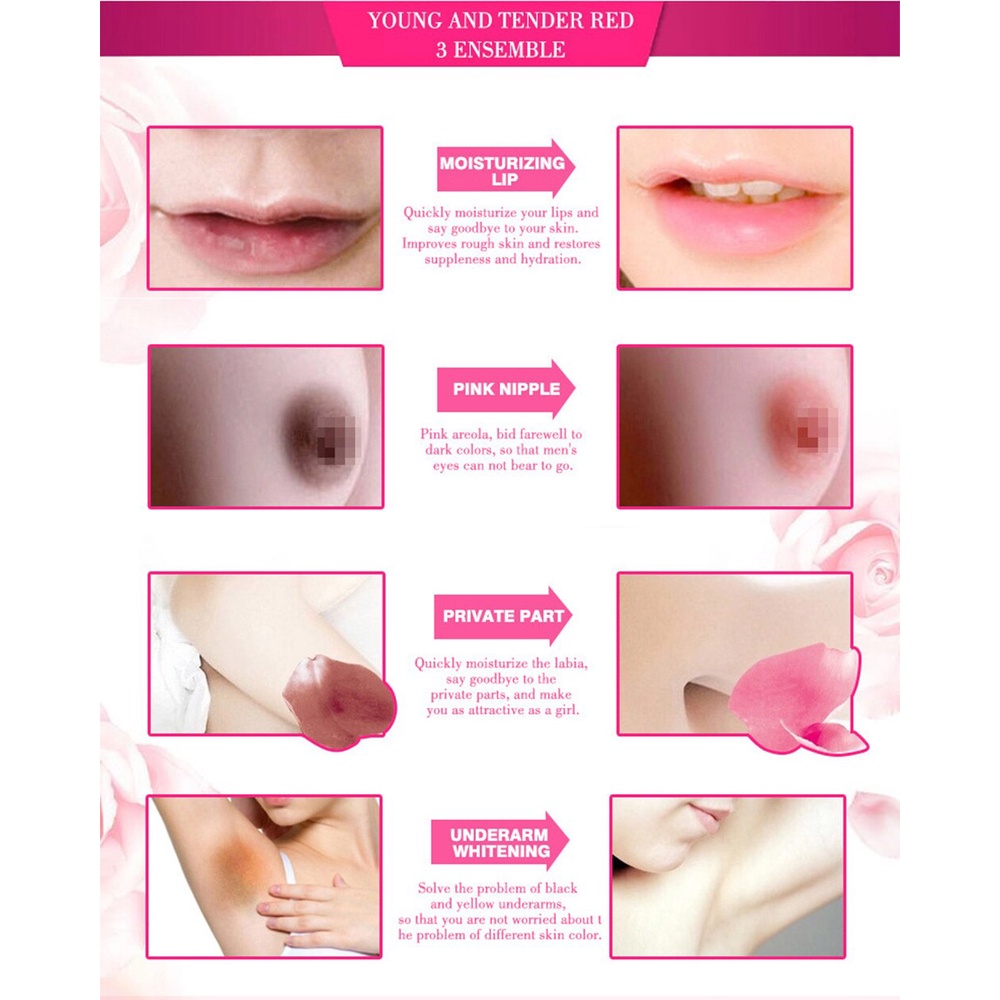 Kem Làm Trắng Hồng Da Vùng Dưới Cánh Tay/Vùng Kín/Vùng Kín Cho Nữ