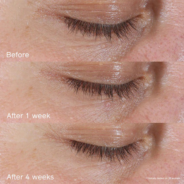 SHISEIDO 🏆 Kem dưỡng mắt Benefiance Wrinkle Smoothing Eye Cream | BigBuy360 - bigbuy360.vn