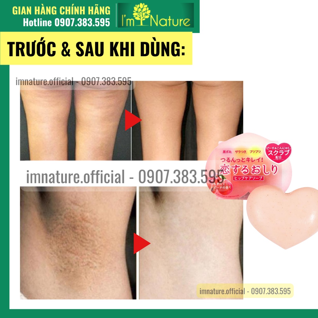 Xà Phòng Giảm Thâm Dưỡng Sáng Mông Pelican For Back 80g Trái Đào