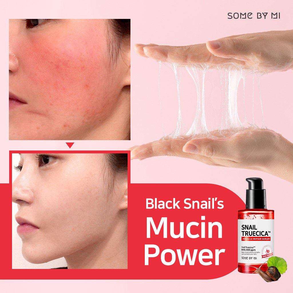 Serum Ốc Sên Đỏ SOME BY MI Snail Truecica Miracle Repair tinh chất phục hồi vết thâm sẹo lõm