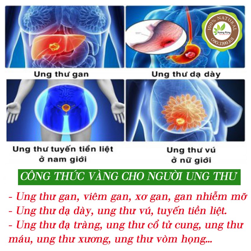 [NẤM LIM RỪNG] NẤM LIM XANH 100g, CÂY TO, ĐẶC TRỊ UNG THƯ, tiểu đường, tim mạch - ĐẶC SẢN HƯƠNG RỪNG