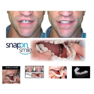 Dụng cụ bọc răng silicon snapon smile