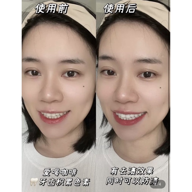 Kem Đánh Răng Crest Trắng Răng Thơm Miệng