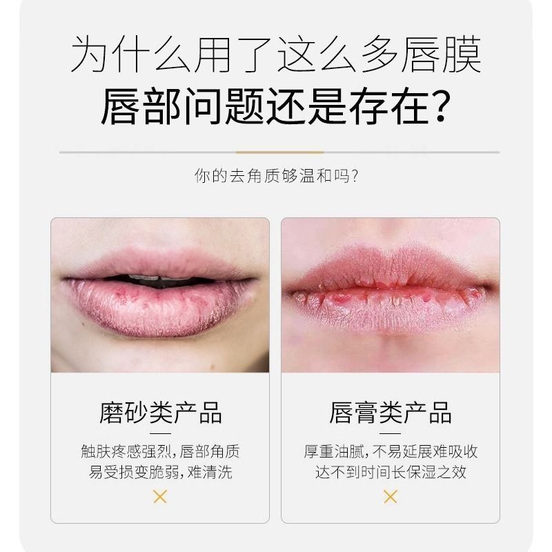 (hàng Mới Về) Mặt Nạ Môi Mật Ong Dưỡng Ẩm Chăm Sóc Môi | BigBuy360 - bigbuy360.vn