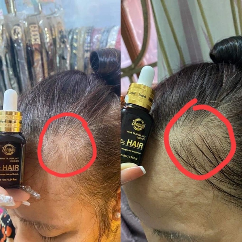 Tinh Chất Serum Dài Mi Mọc Tóc Dr Hair Zenpali [Chính Hãng] Amberhuynh_93 | BigBuy360 - bigbuy360.vn