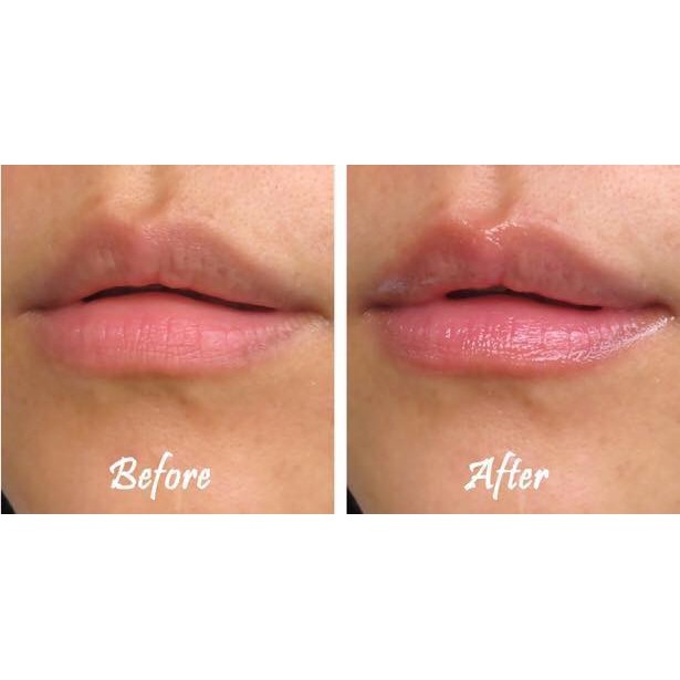 Son Dưỡng Dior Addict Lip Maximizer Collagen Activ