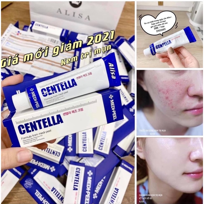 Kem rau má giảm mụn và phục hồi da - ALISA