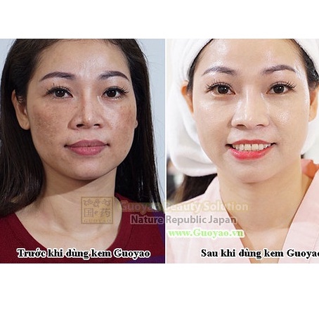 Kem Sâm GUOYAO Nhật Bản Loại 1