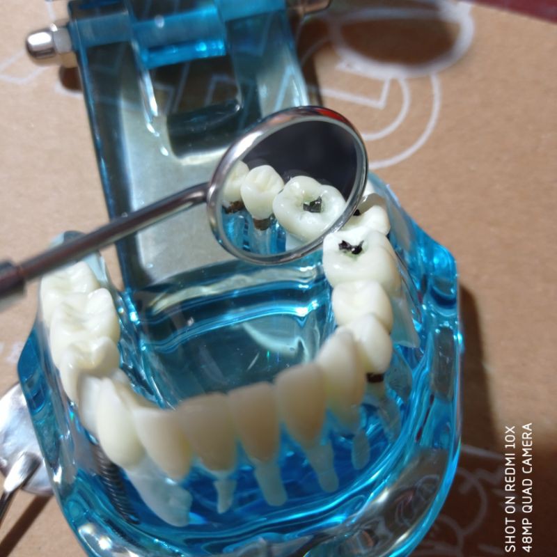 12 chiếc mặt gương rời chuẩn parkistan