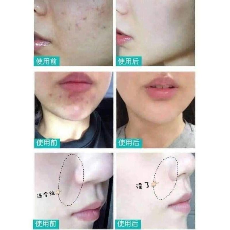 Serum - Kem dưỡng trắng căng bóng Rejuran Healer Turnover Cream 50ml