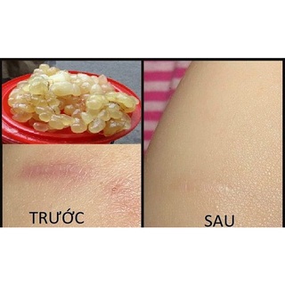 MỠ TRĂN DƯỠNG DA SAU WAX LÔNG
