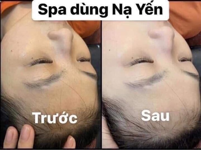 Dịch yến trắng da magic skin