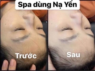 Dịch yến trắng da magic skin