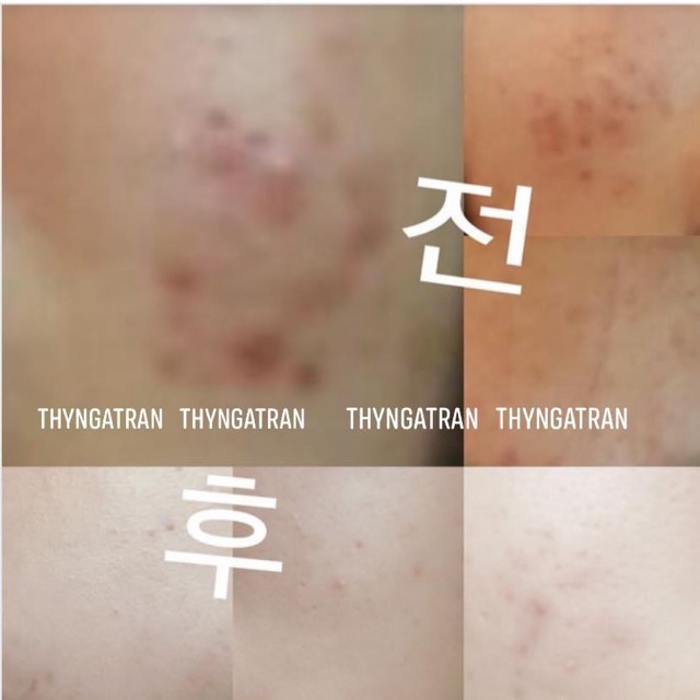 [Bill Hàn] TONER cho da mụn Etude House SOON JUNG pH 5.5 Relief Toner | BigBuy360 - bigbuy360.vn