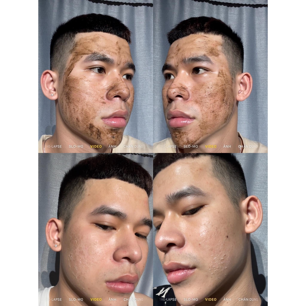 LE’PEAU - Peel da Vi Tảo Retinol của công ty Việt Nam