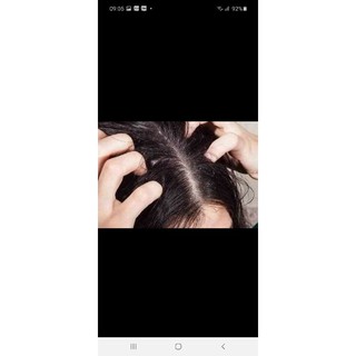 DẦU GỘI TRỊ GÀU