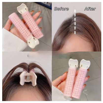 Set 2 Lô Kẹp Phồng Chân Tóc Có Kẹp Giữ Cố Định Tóc Mái Siêu Xinh