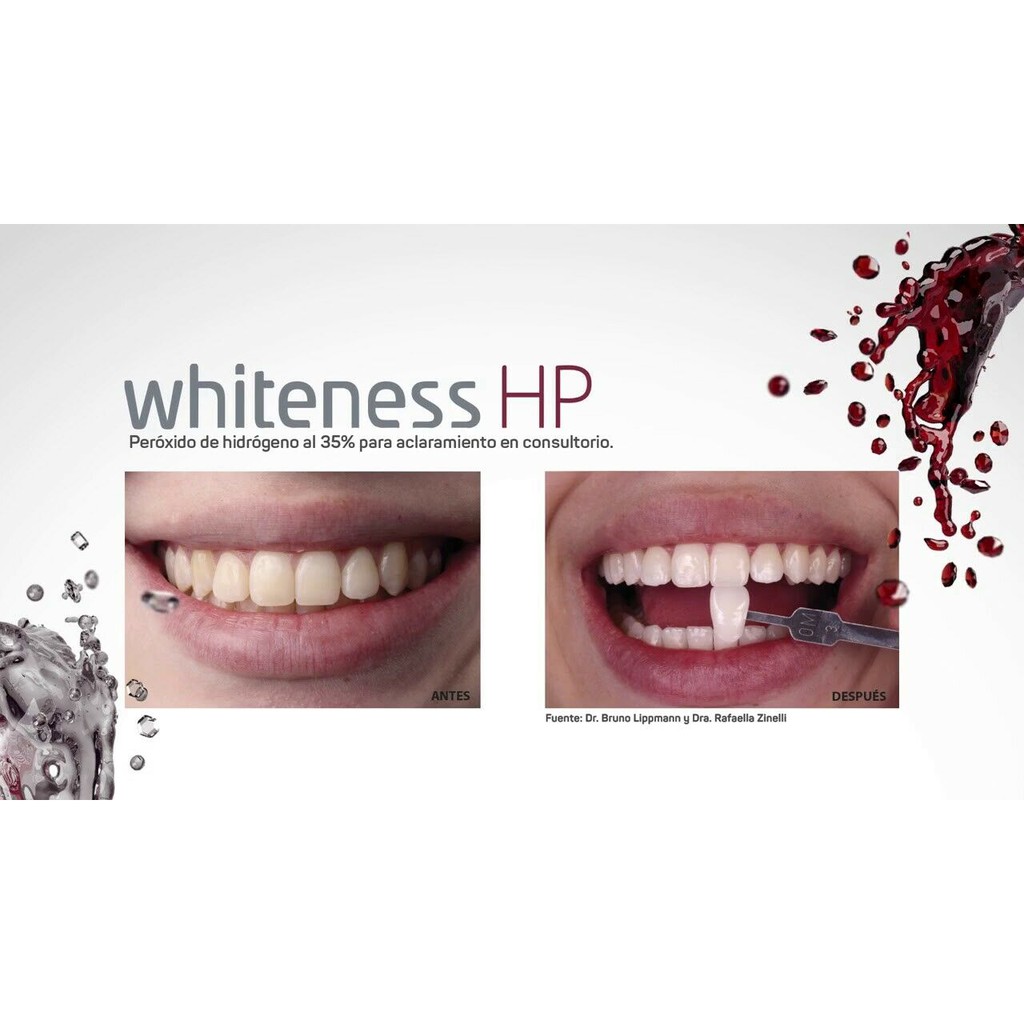 Tẩy trắng răng tại phòng khám WHITENESS HP MAXX 35%