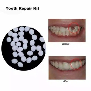 Gel Đánh Răng Giả 100-120 Có Âm Thanh Chất Lượng Cao