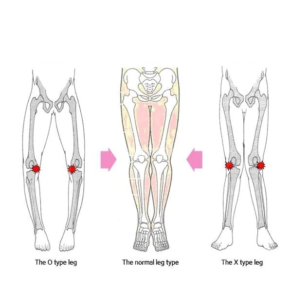 Bộ 3 vải thun cố định chân đùi cẳng chân thiết kế tập thể thao tiện lợi