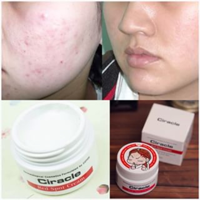 Kem giảm mụn Red Spot Cream Ciracle