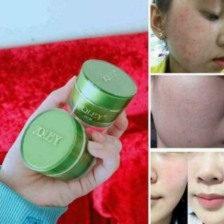 Face Zoley xanh cho da mụn