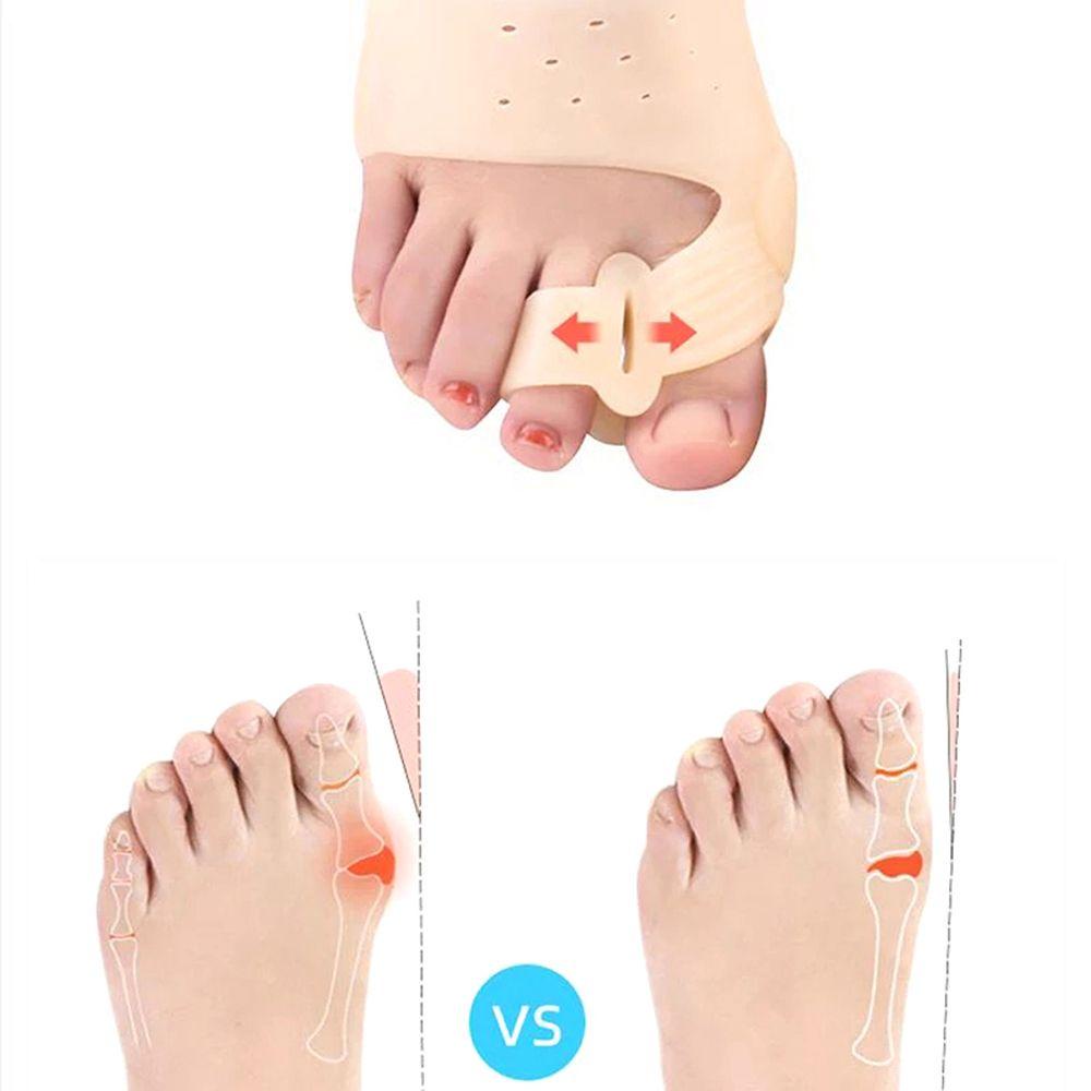 OCEANMAP Dụng Cụ Chỉnh Hình Ngón Chân Cái