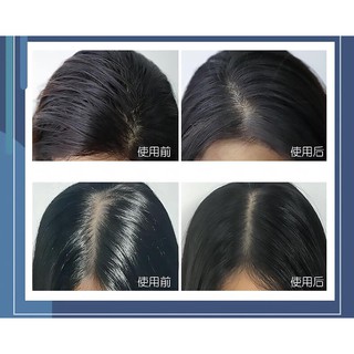 Dầu gội khô isy - baotrietle