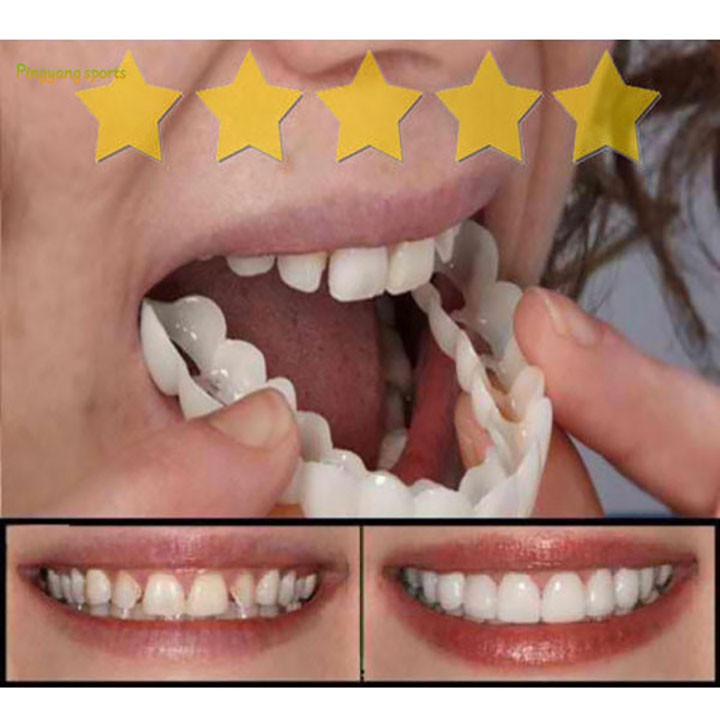 Dụng cụ niềng răng tại nhà snapon smile