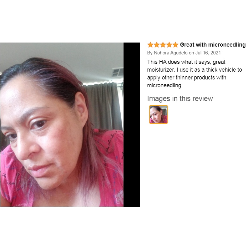 Tinh chất Hyaluronic Acid cấp ẩm căng da thu nhỏ lỗ chân lông cho da dầu khô nhạy cảm