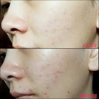 𝐒𝐞𝐫𝐮𝐦 𝐀𝐍𝐑 𝐄𝐒𝐓𝐄𝐄 𝐋𝐀𝐔𝐃𝐄𝐑 mẫu mới đậm đặc gấp 5 lần