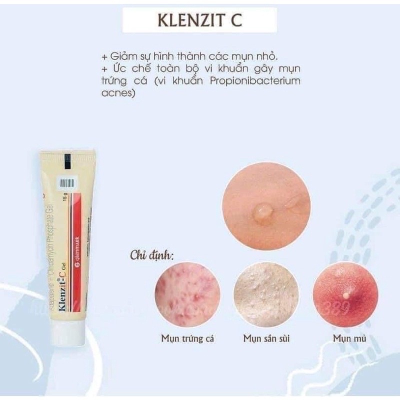 Gel Giảm Mụn KlenzittC 15g